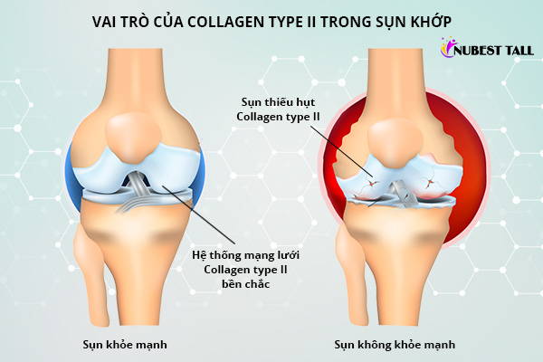 Collagen type II gia tăng độ chắc khỏe, sự trơn tru của sụn